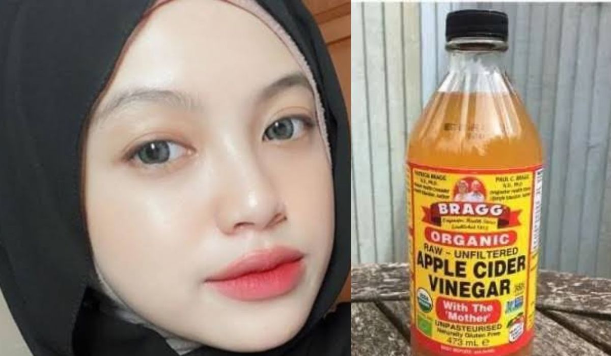 Bagaimana Untuk Menghilangkan Flek Hitam dan Buat Wajah Glowing Bisa Gunakan Cuka Apel Di Jadikan Masker