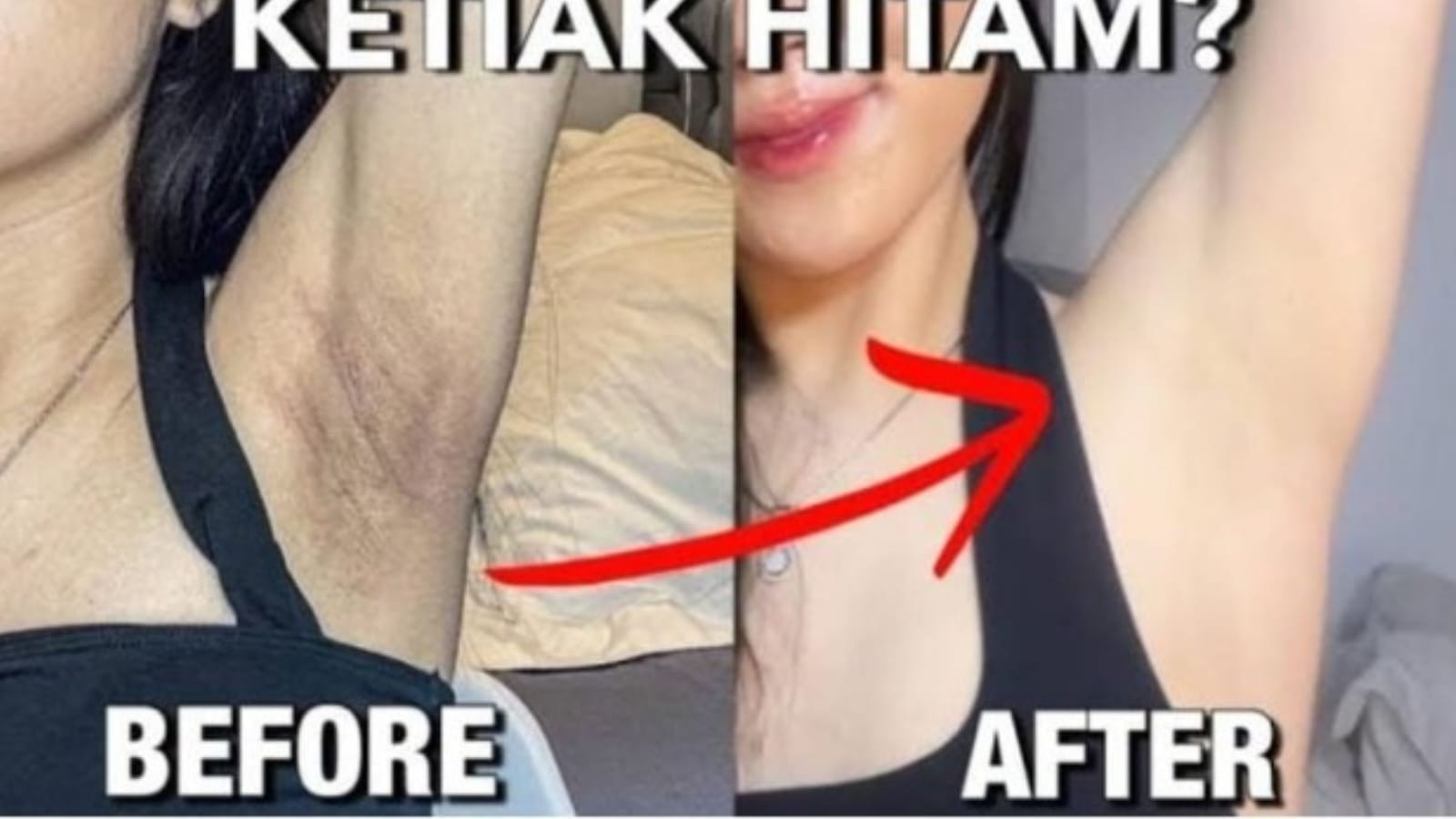 Deodoran Pemutih Ketiak Paling Ampuh di Indomaret dan Alfamart: Mengatasi Ketiak Hitam dengan Efektif