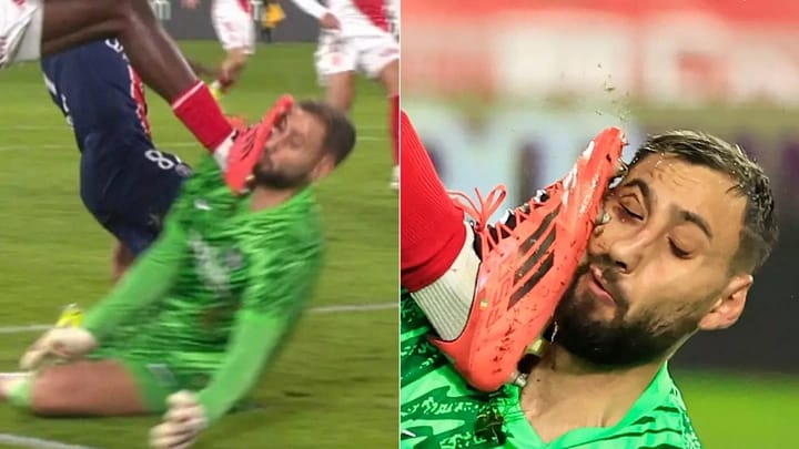 Tragis! Wajah Gianluigi Donnarumma Berdarah-Darah Usai Bentrok Horor dengan Pemain AS Monaco