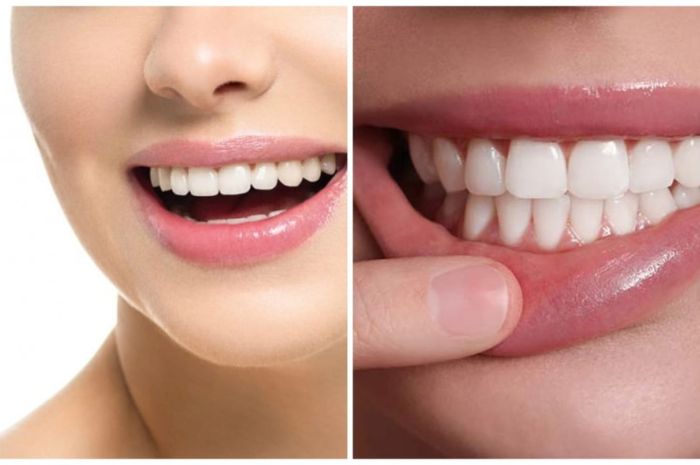 7 Cara Merawat Gigi: Panduan untuk Menjaga Kesehatan Gigi dan Gusi Anda