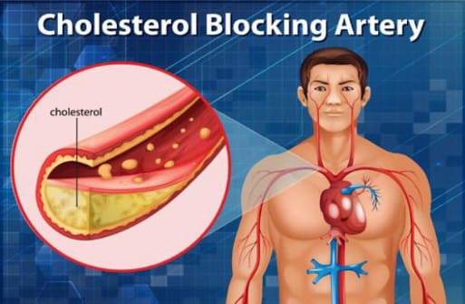 Cek 8 Cara Menurunkan Kolesterol Secara Alami di Sini