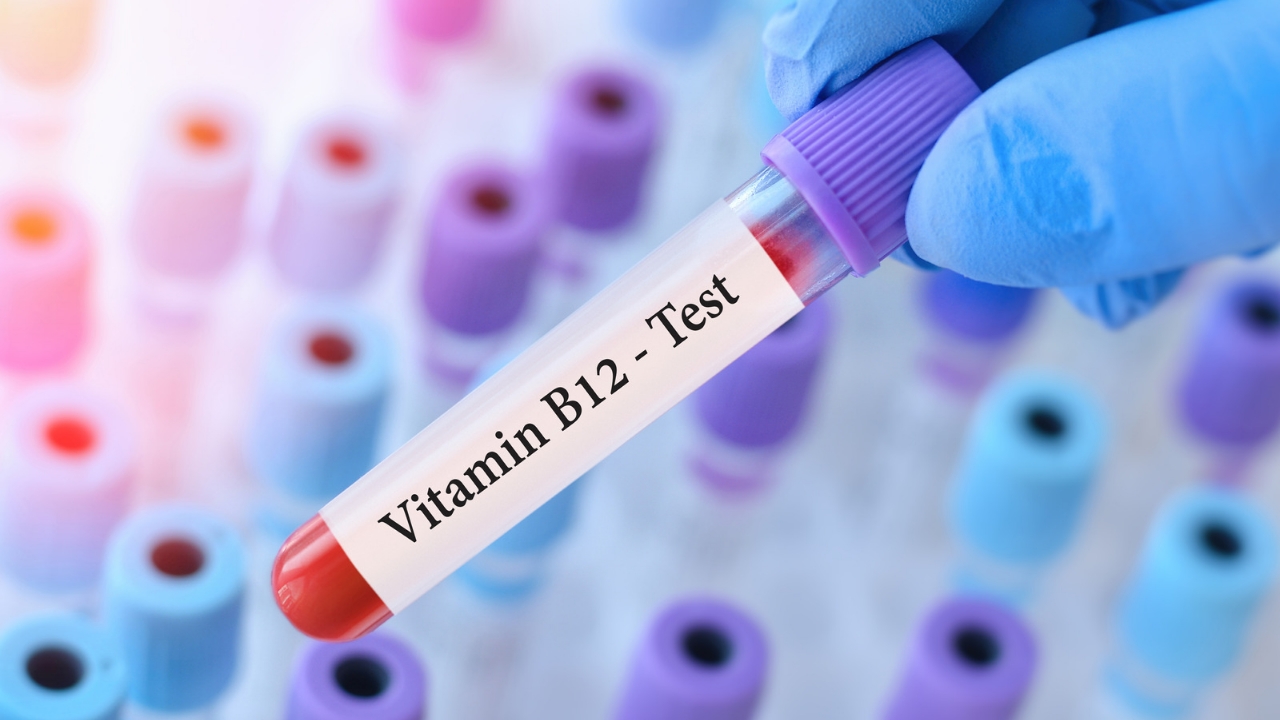 Vitamin B12 Kunci Penting dalam Mencegah dan Mengatasi Rambut Uban