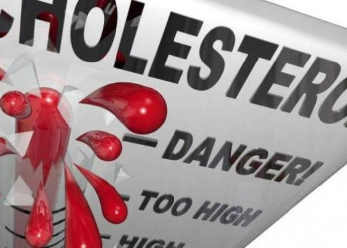 Mendeteksi Kolesterol Tinggi: 3 Gejala Penting yang Harus Anda Perhatikan