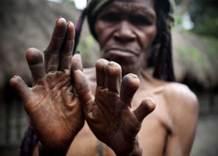 Tradisi Potong Jari, Ekspresi Kesedihan Ekstrem di Pegunungan Tengah Papua