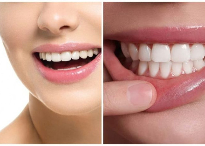 7 Cara Merawat Gigi: Panduan untuk Menjaga Kesehatan Gigi dan Gusi Anda