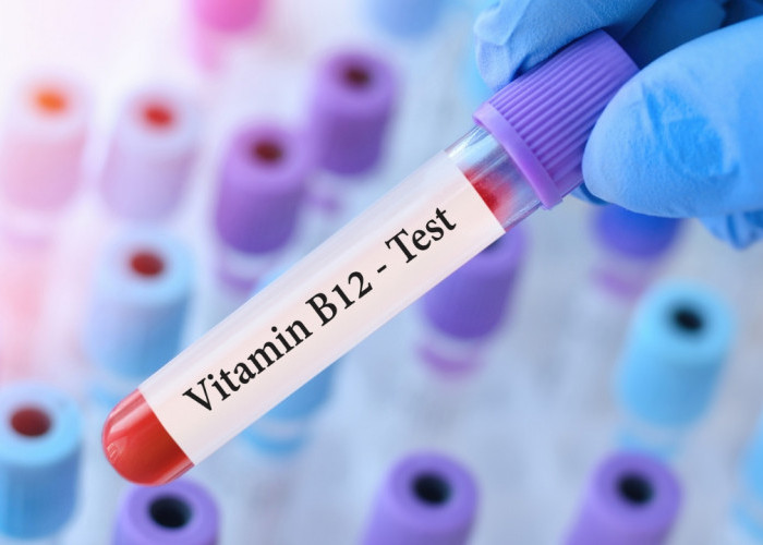 Vitamin B12 Kunci Penting dalam Mencegah dan Mengatasi Rambut Uban